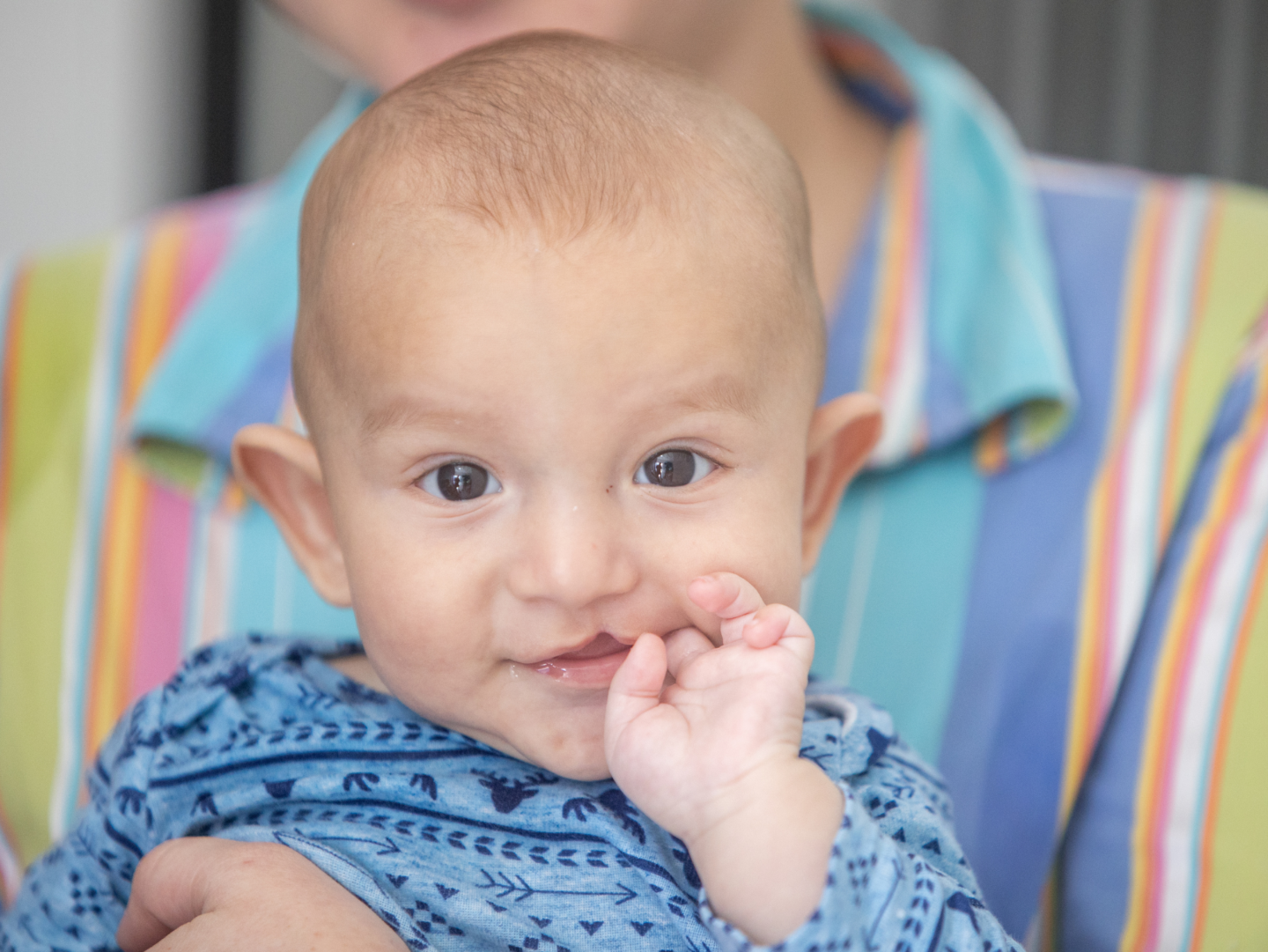 Samuel looks at the camera before his surgery at a surgical program in Guatemala.