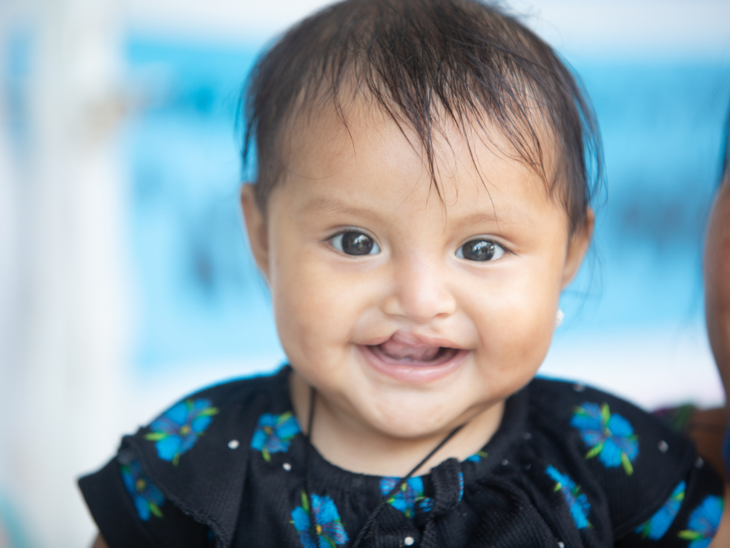 Melinda smiles before her surgery.