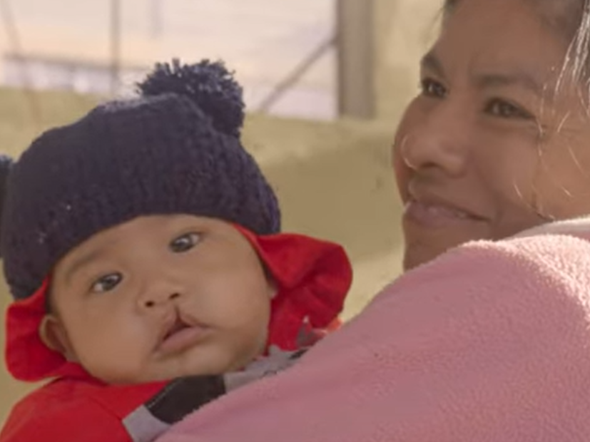 Mateo's mom hold him while at a surgical program in Puebla, Mexico.